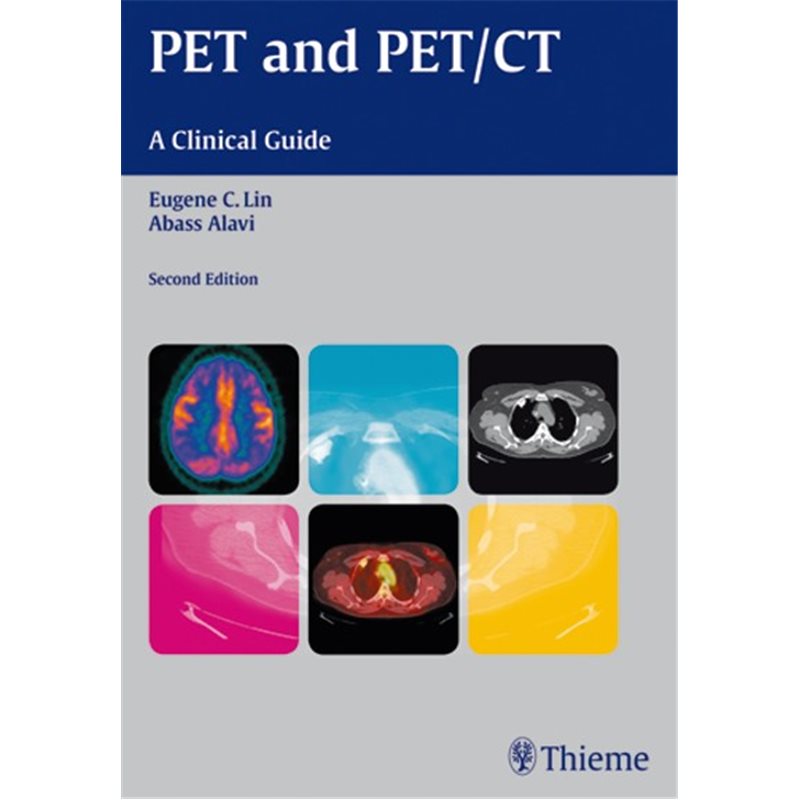 PET and PET/CT - A Clinical Guide